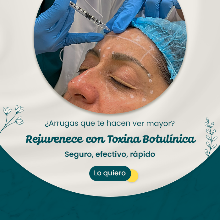 Comparativa del rostro de una mujer antes y después de un tratamiento estético integral con toxina botulínica, Radiesse y limpieza facial; se muestra un lado con signos de envejecimiento y el otro con piel más firme y rejuvenecida.