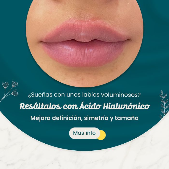 Comparativa de nariz con puntos negros y piel limpia tras tratamiento facial de limpieza profunda, junto a mensaje promocional
