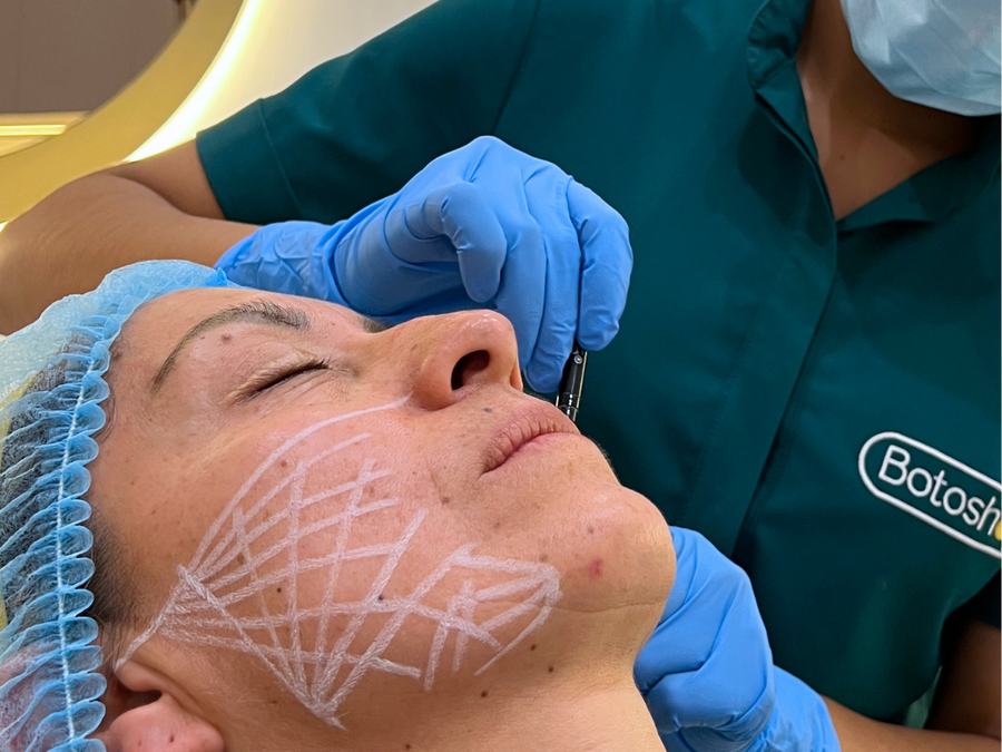 Aplicación de Lifting Facial en Botoshop