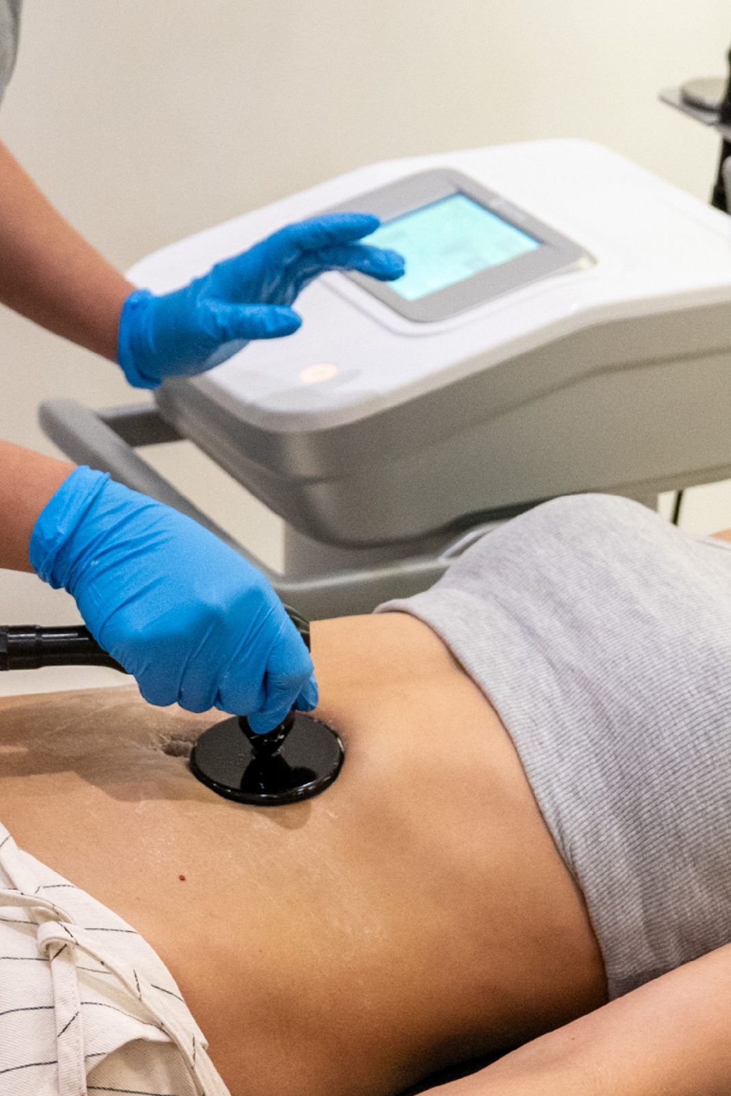 Tensamax corporal antes y después en abdomen - Botoshop Bogotá