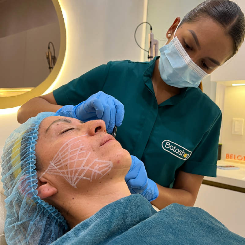 Bioestimuladores de Colágeno