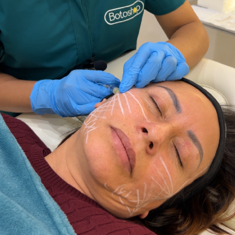 Rejuvenecimiento Facial