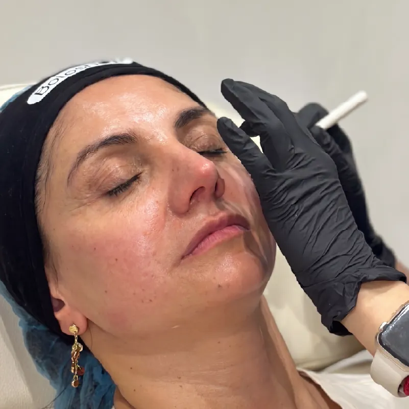 Lifting facial Combo Bogotá