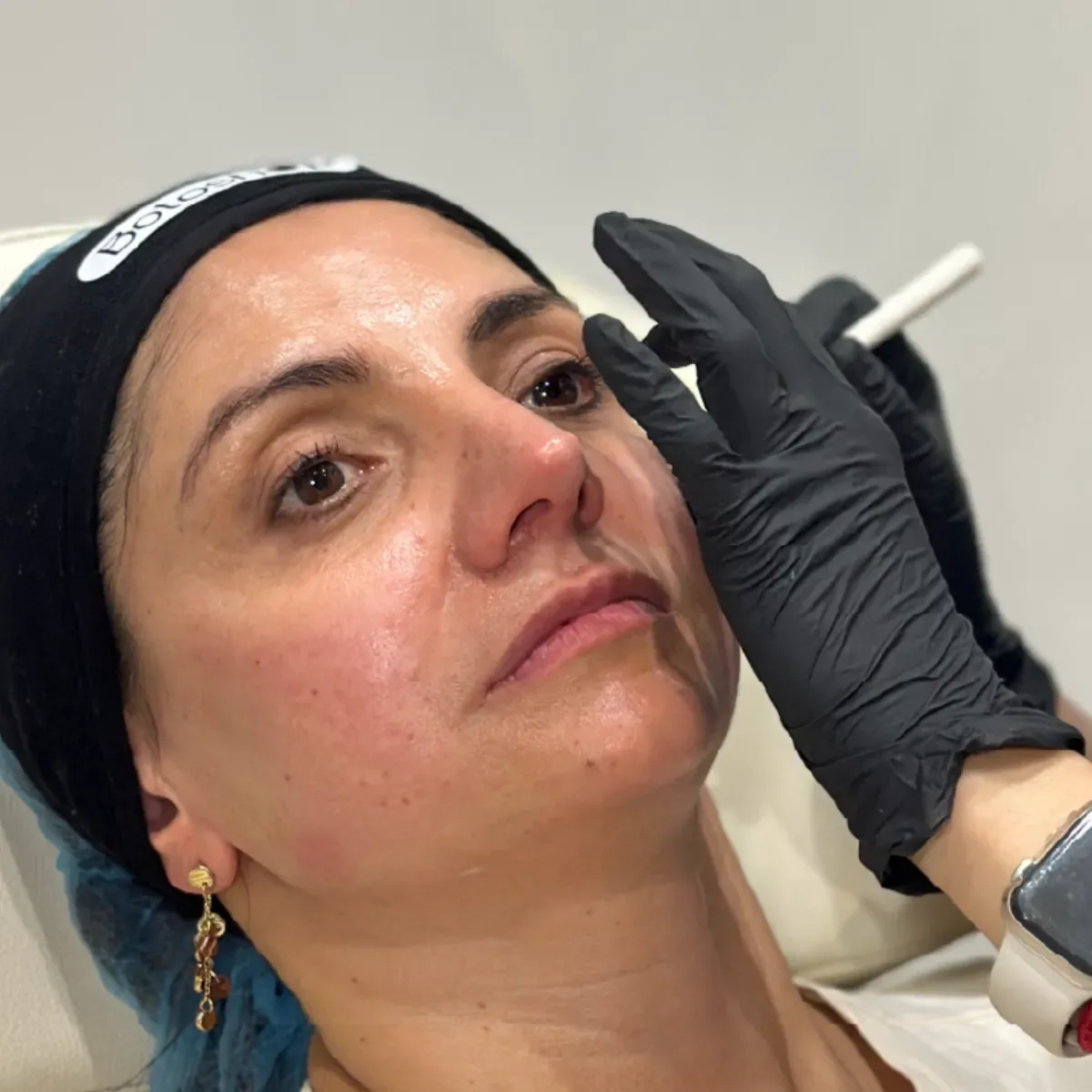 Lifting facial Combo Bogotá
