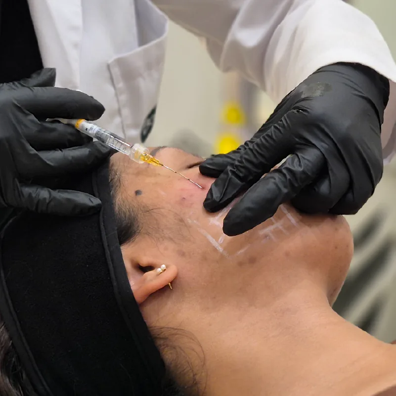 Combo Piel Joven en Botoshop Bogotá — Toxina Botulínica + Ácido Hialurónico Skinvive para rejuvenecimiento natural