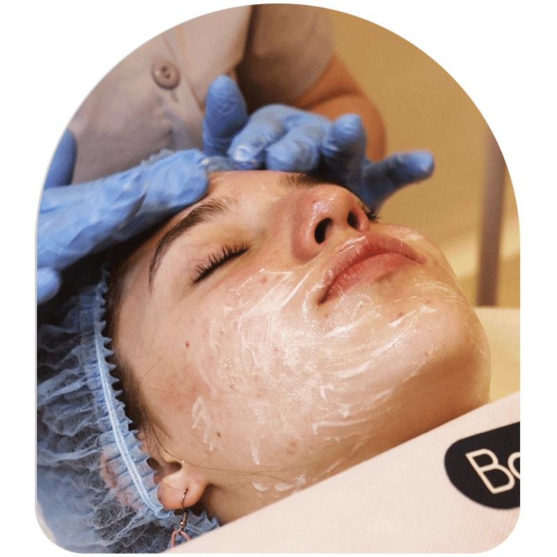 Limpieza Facial Profunda+ Peeling Facial