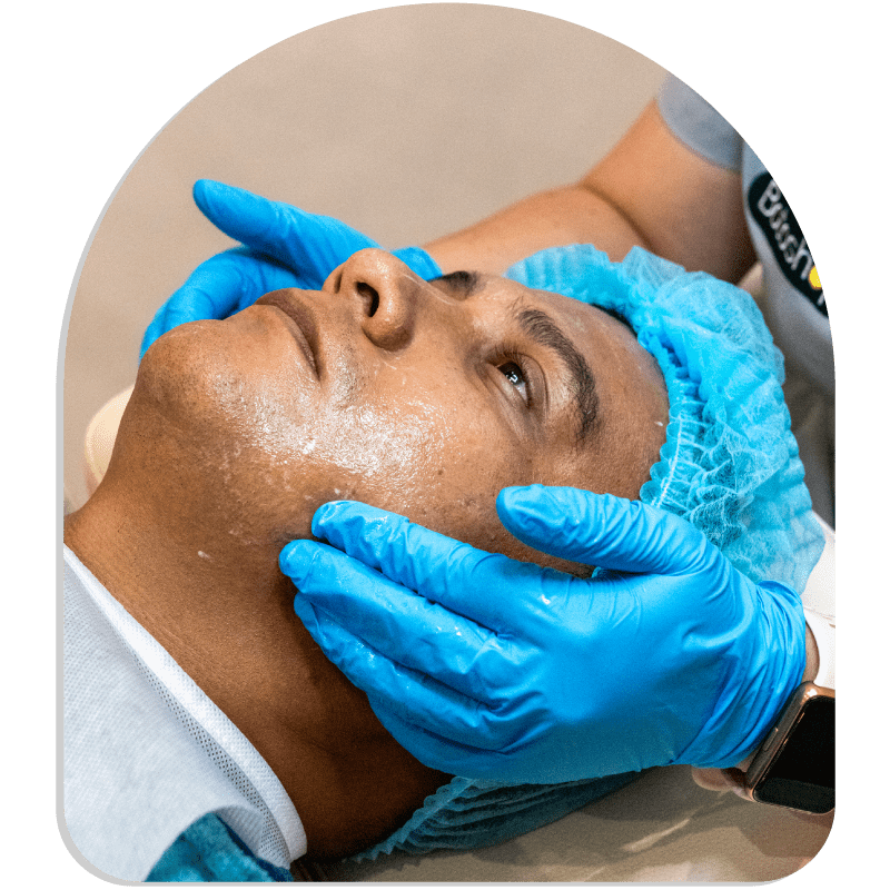 Peeling Facial - Renueva tu Piel