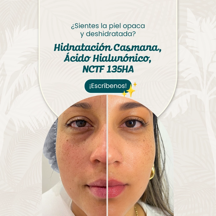 Comparativa facial femenina mostrando mejora en hidratación y luminosidad tras tratamiento estético no invasivo, junto a mensaje promocional