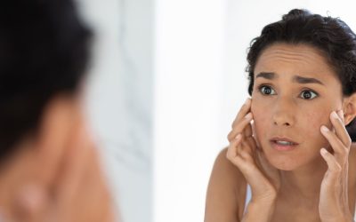 ¿Por qué el Bótox deforma la cara?