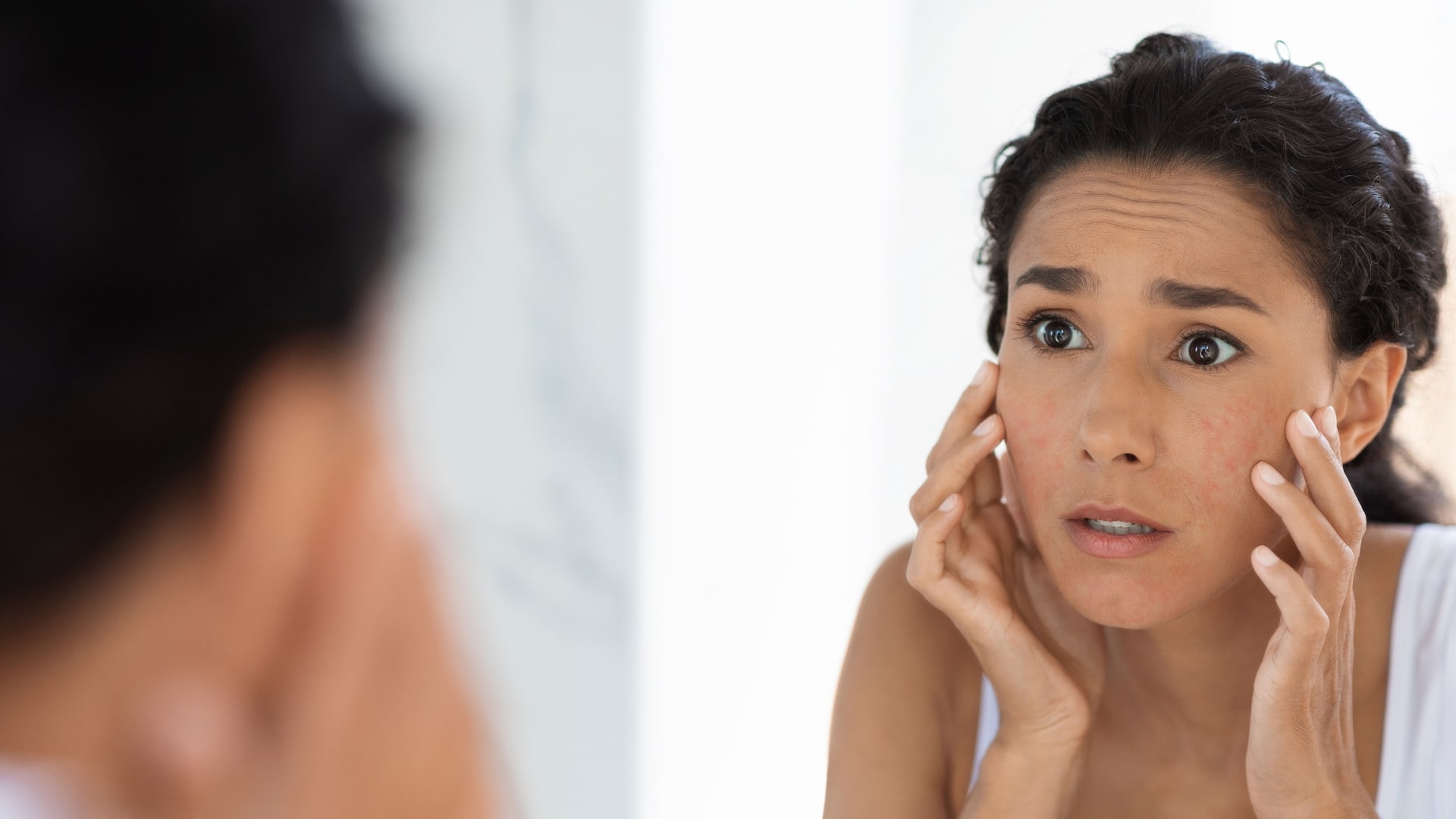 El Bótox realmente deforma la cara?