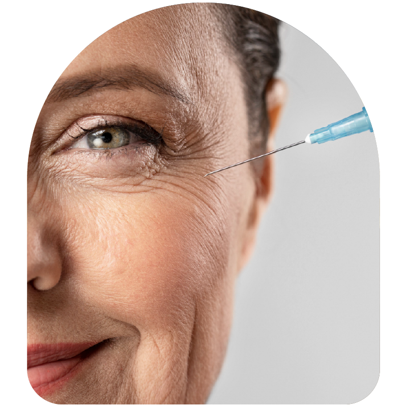 Botox en Bogotá