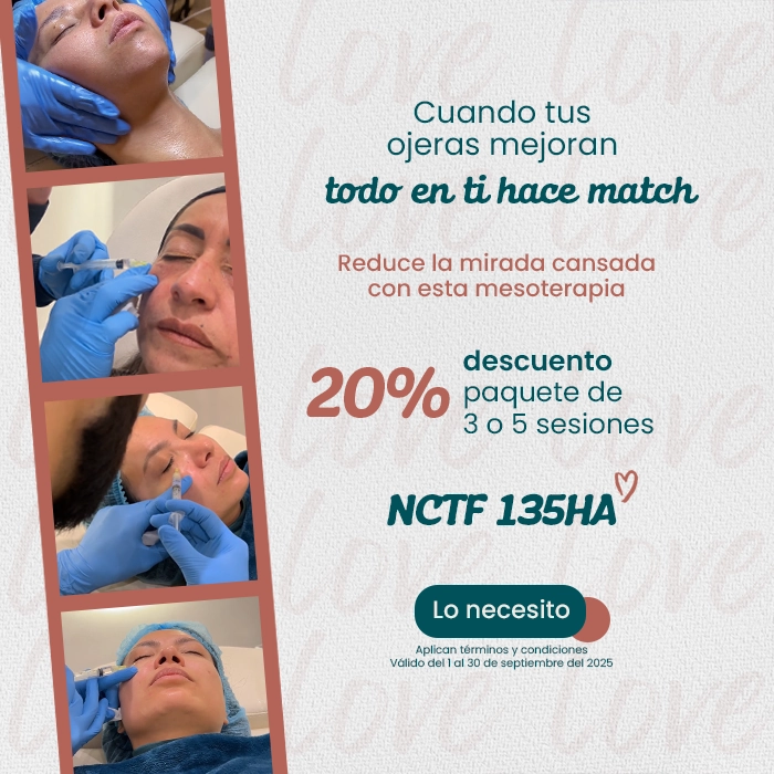 Comparativa de frente femenina antes y después de tratamiento estético con toxina botulínica, enfocada en la reducción de arrugas
