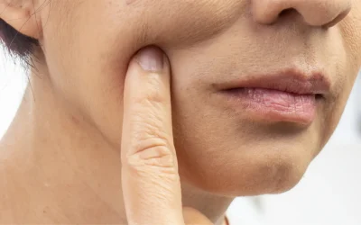 Rejuvenecimiento facial en Bogotá: todo lo que necesitas saber