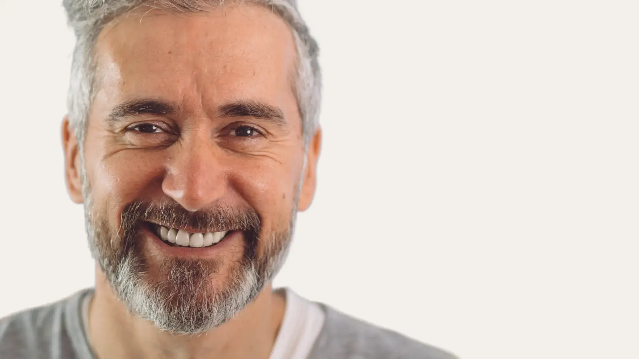 optimized_1 Hombre sonriendo con arrugas en el tercio superior