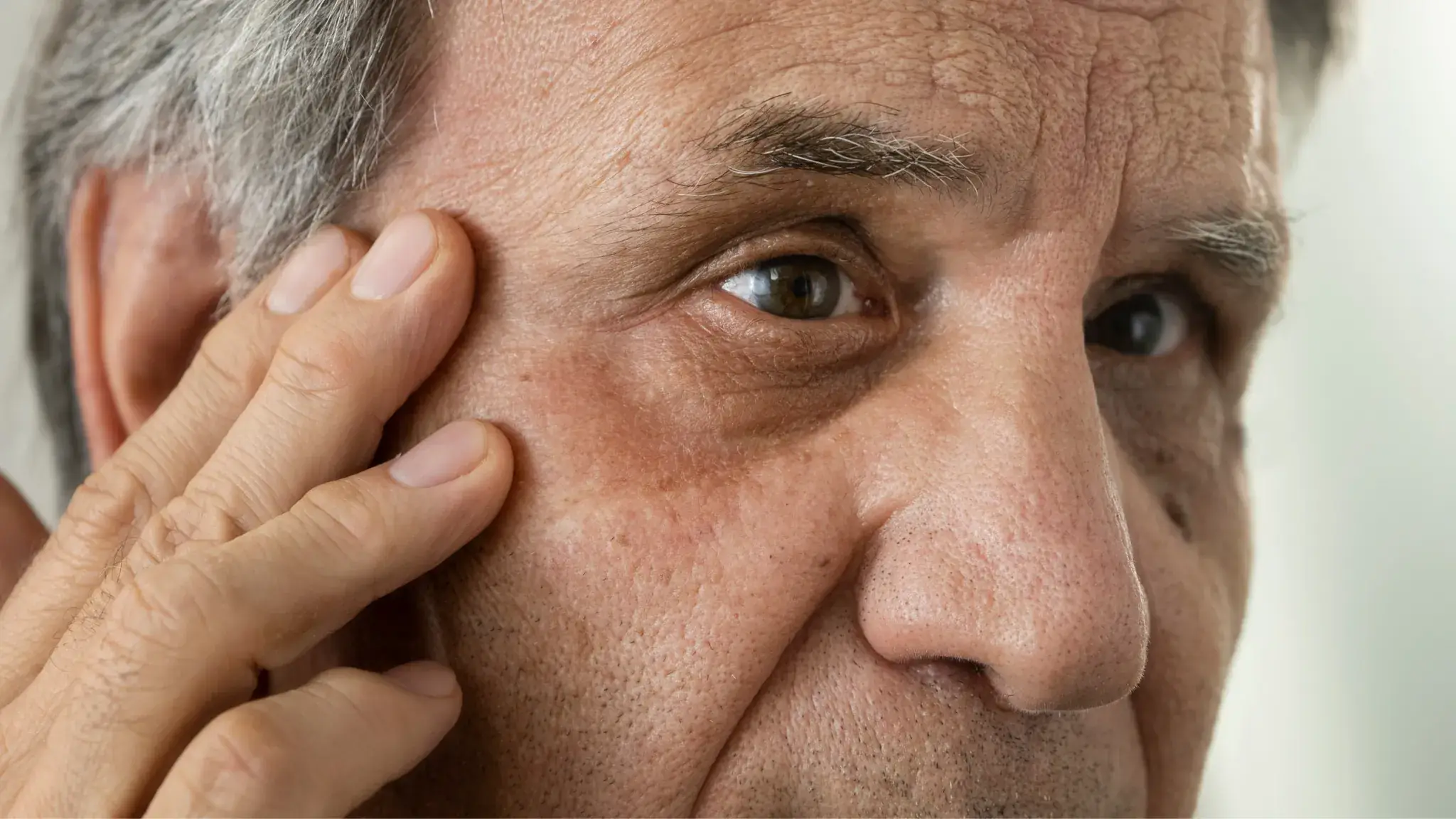 Hombre de cerca con signos de envejecimiento como arrugas y flacidez