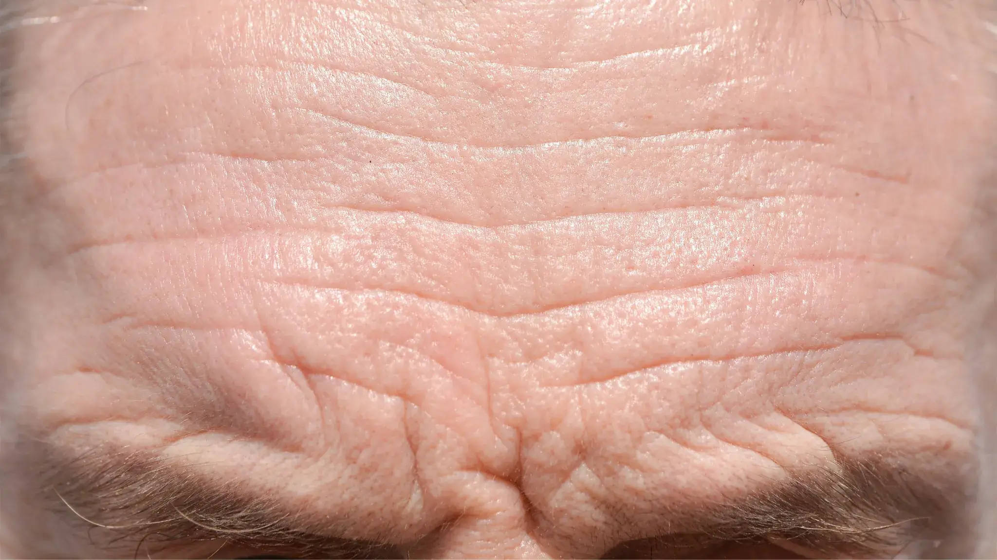 Hombre frunciendo el ceño, ideal para aplicación de Toxina Botulínica en Bogotá