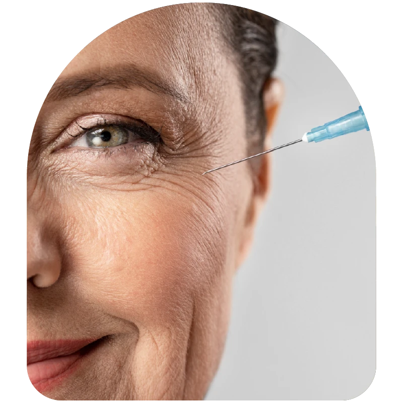 Botox en Bogotá